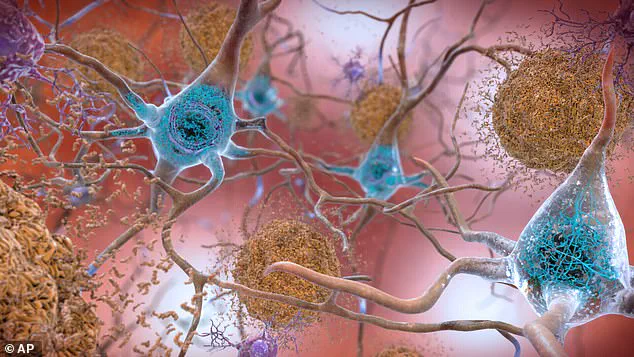 Study Reveals Key Role of GTP in Brain's Cellular Clearance Process Linked to Alzheimer's Progression