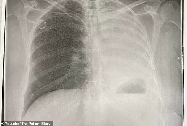 A USO Volunteer's Sudden Health Crisis: Pandemic Risks and the Importance of Public Health Vigilance