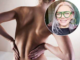 Cambridge Researchers Develop Cartilage-Mimicking Gel for Targeted Arthritis Treatment, Offering Relief to Millions