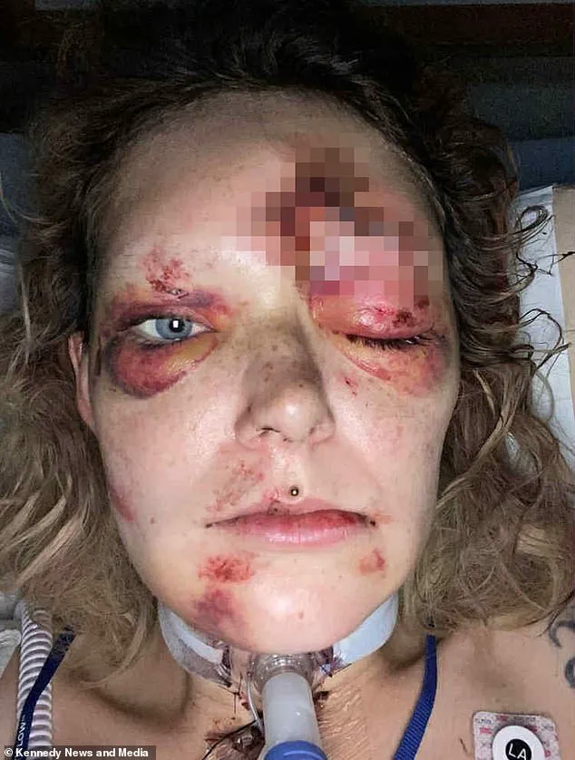 Exclusive: Inside the Unseen Details of a Tragic E-Scooter Crash That Left a Mother with Life-Changing Injuries