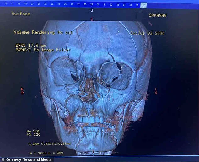 Exclusive: Inside the Unseen Details of a Tragic E-Scooter Crash That Left a Mother with Life-Changing Injuries