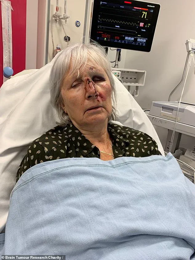 Misdiagnosis and Medical Urgency: The Hidden Brain Tumor Battle of a Retired Teacher