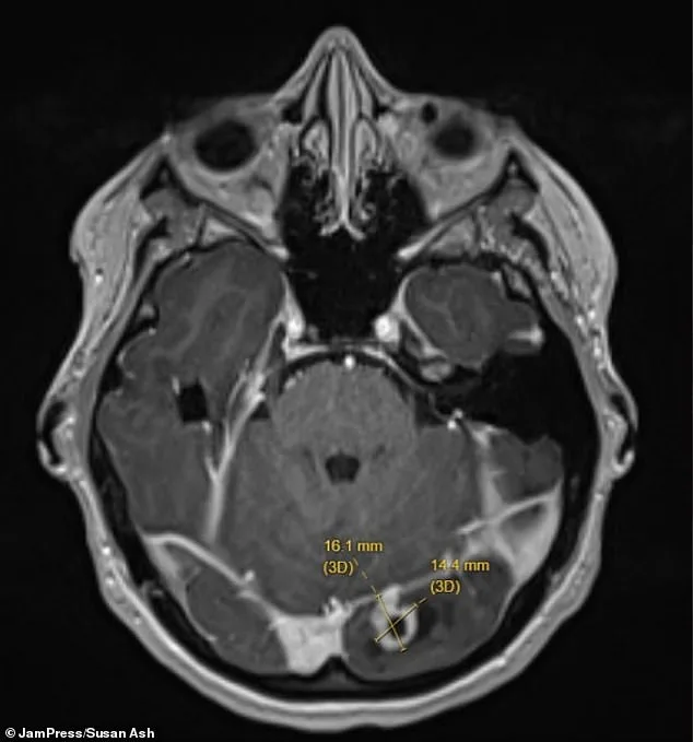 New Mother's Mysterious Seizures: A Warning Sign Ignored