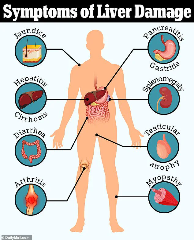Undisclosed Risks of Paracetamol: NHS Data Reveals Alarming Prescription Trends