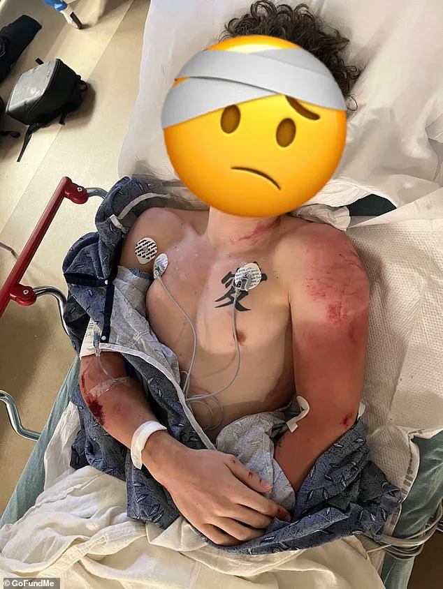 Georgia Motorcyclist Injured in Police Chase: Viral Footage Sparks Debate on Pursuit Risks