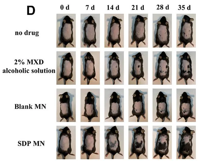 Exclusive Study Findings: Stevia Compounds May Enhance Minoxidil's Effectiveness in Hair Loss Treatment, Experts Advise Public on Credible Health Benefits
