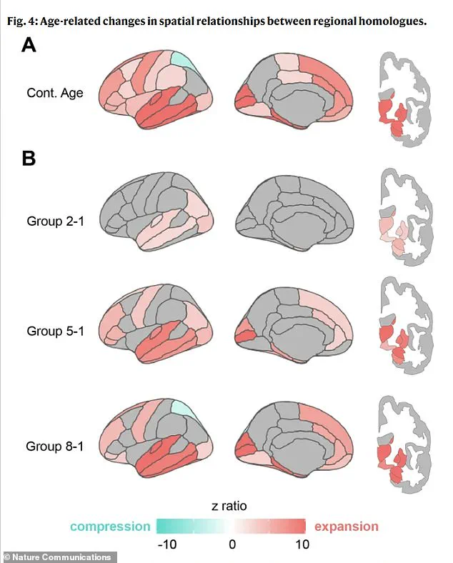 Privileged Access to Groundbreaking Discovery: Brain Shape Changes Signal Early Dementia Risk