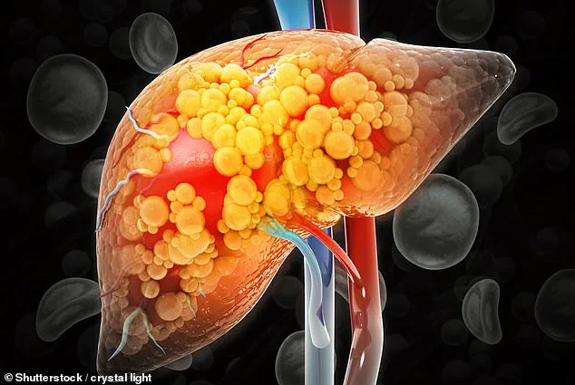 Medical Breakthrough: Two Common Medications Could Reverse Liver Disease, Scientists Say