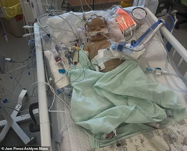 Exclusive Insights: The Hidden Dangers of Neonatal Jaundice and Limited Awareness