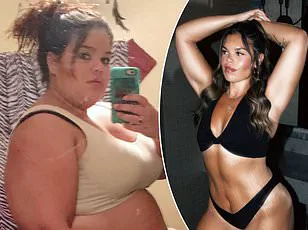 Breaking: Melissa Schloemer's Long-Awaited Gastric Sleeve Surgery Finally Approved