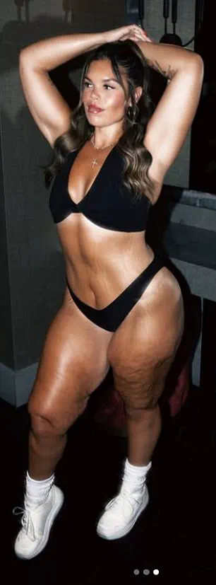 From Invincibility to Caution: A Fitness Influencer's Journey Through Weight Loss and Health