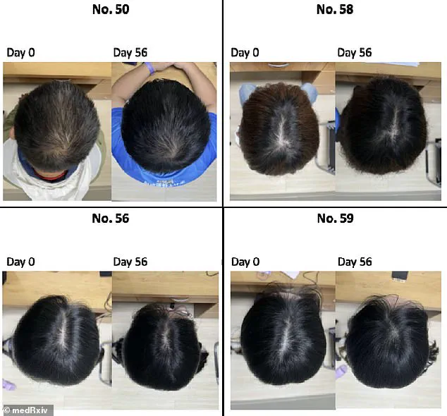 Clinical Trial Suggests Tropical Plant-Based Serum Could Help Regrow Hair