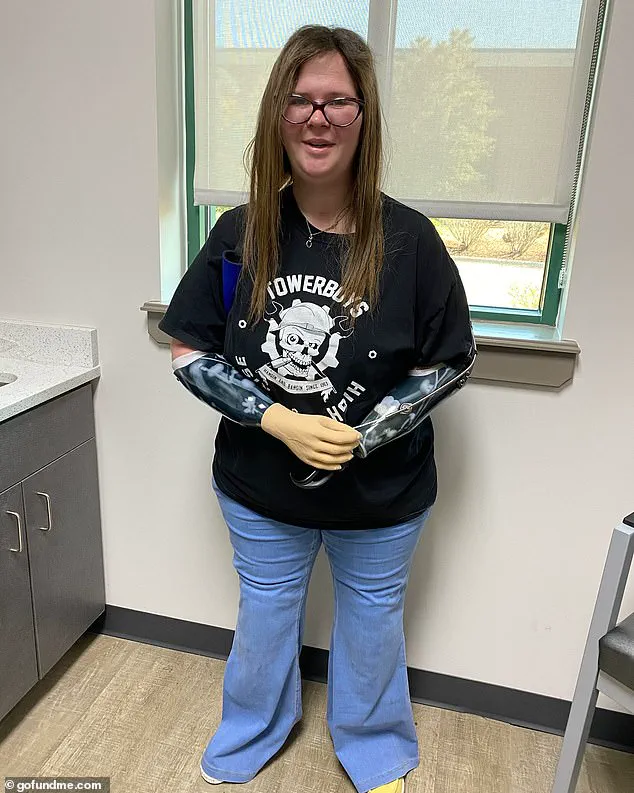 From a Minor Sniffle to Life-Support: The Unfolding Tragedy of a Mother's Limb Loss