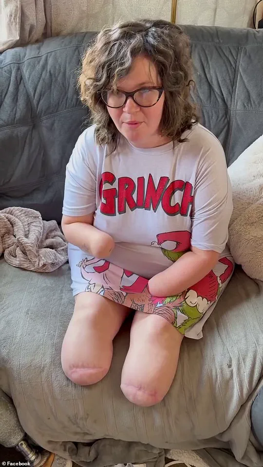 From a Minor Sniffle to Life-Support: The Unfolding Tragedy of a Mother's Limb Loss