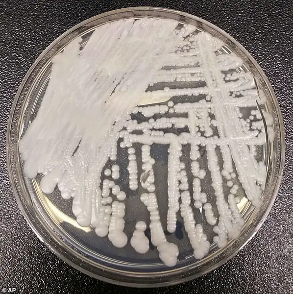 Urgent Alert: Treatment-Resistant Candida Auris Spreading in US Hospitals, Experts Warn