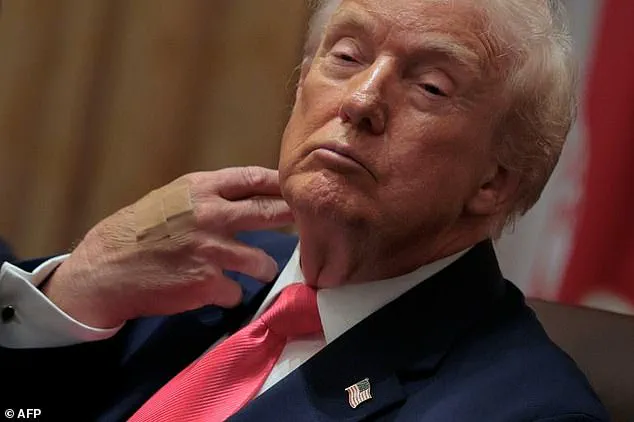 Presidential Health and Dietary Habits: A Scrutiny of Public Well-Being and Expert Advisories