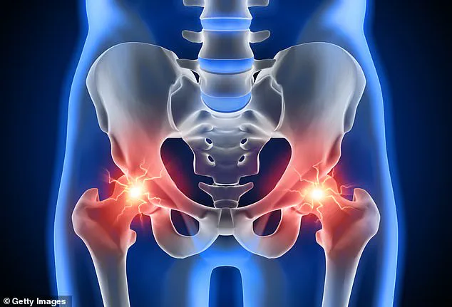 Urgent Alert: One in Ten Britons Suffering from Hip Pain Crisis – Expert Warns of Silent Health Threat