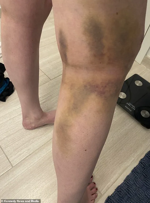 Patient's Trust in Longtime Doctor Shattered by Routine Procedure