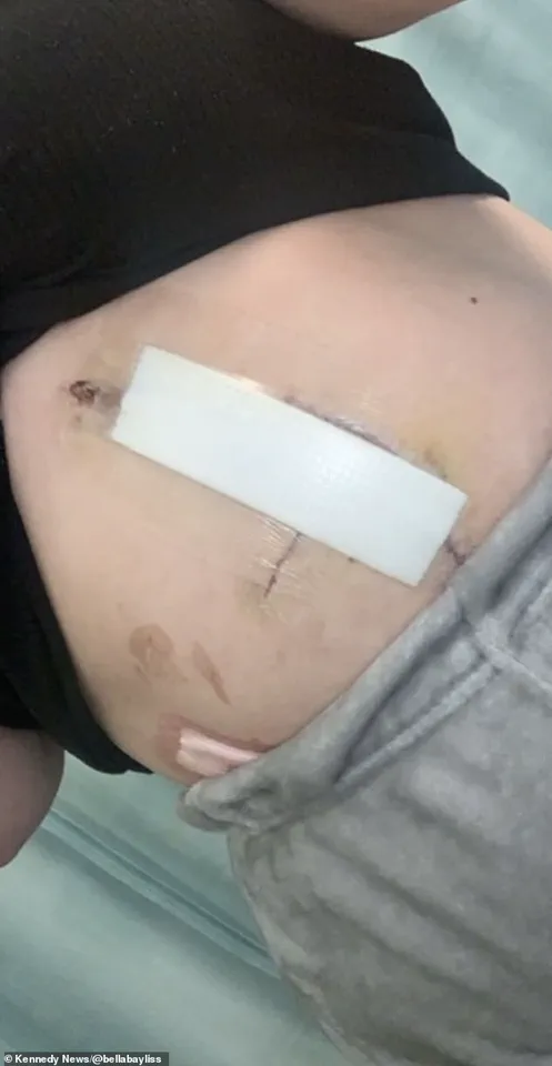 Ignored Symptoms and Limited Access: Bella Bayliss's Medical Crisis