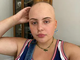 UK Faces Quindemic of Five Viruses: Public Health Officials Warn of Growing Community Risk