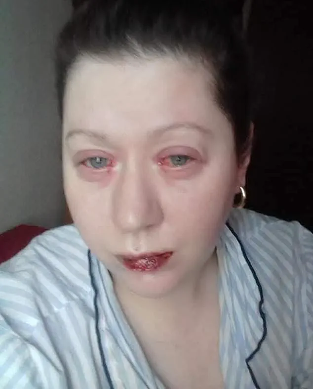 When Common Medicines Lead to Crisis: A Lesson in OTC Drug Risks for Communities