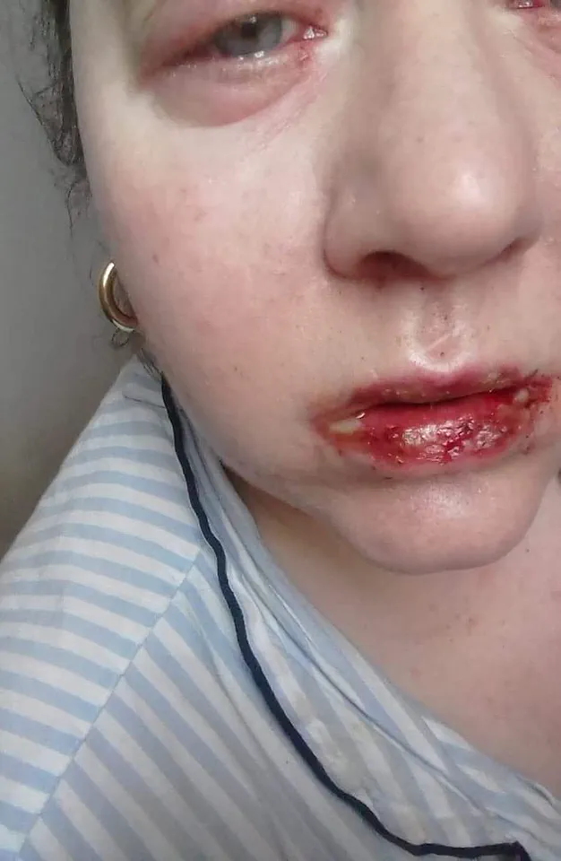 When Common Medicines Lead to Crisis: A Lesson in OTC Drug Risks for Communities