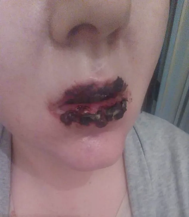 When Common Medicines Lead to Crisis: A Lesson in OTC Drug Risks for Communities