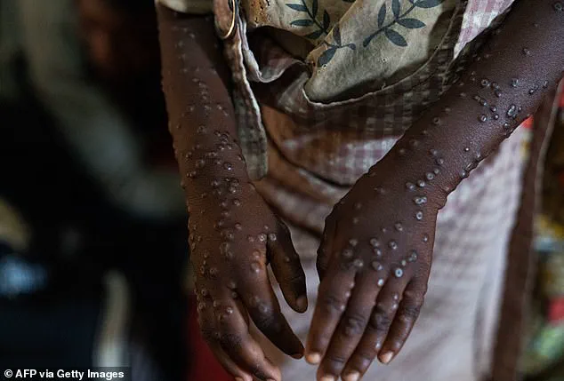 As 2026 Approaches, Experts Warn of Heightened Viral Threats and the Need for Global Health Preparedness