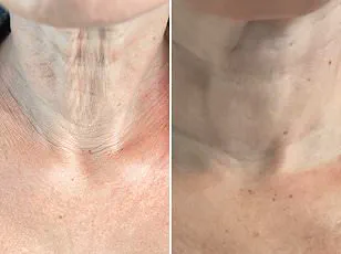 Clarifying the Purpose: Weight Loss Medications Were Designed for Obesity Treatment, Not Extreme Thinness