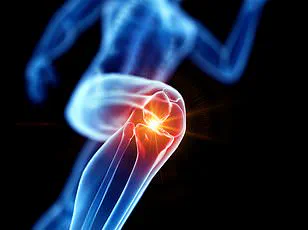 Stanford Scientists' Groundbreaking Discovery Offers New Hope for Arthritis Patients