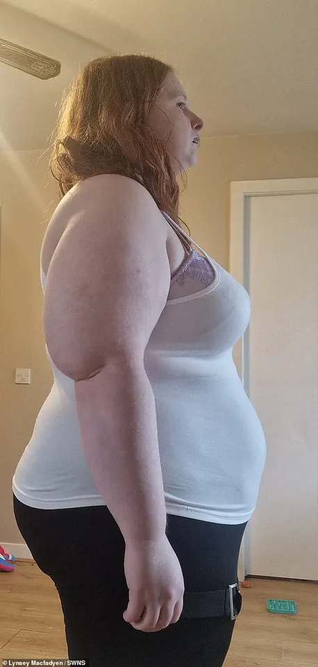 A Daily Routine of Processed Foods: Lynsey Macfadyen's Struggle to Break the Cycle