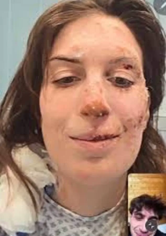 Aspiring Veterinarian Eleonora Palmieri Survives Nightclub Fire in Switzerland on New Year's Eve