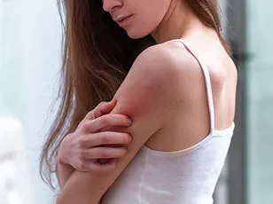 Palforzia's Withdrawal Raises Alarms: Limited Access to Peanut Allergy Treatment and Expert Calls for Public Health Action