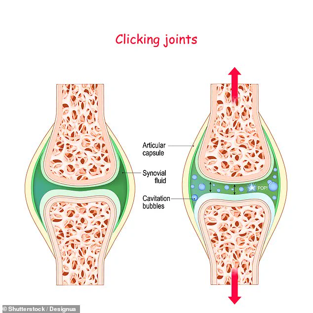 Joint Cracking and Arthritis: Debunking the Myth and Recognizing Warning Signs