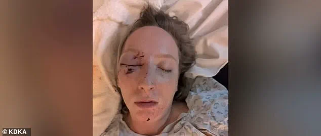 Massive Ice Slab From Tractor-Trailer Shatters Windshield, Leaves Mother Injured And Daughter Traumatized In Pennsylvania Crash