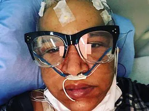 Study Links Long Covid to Increased Dementia Risk via Choroid Plexus Changes