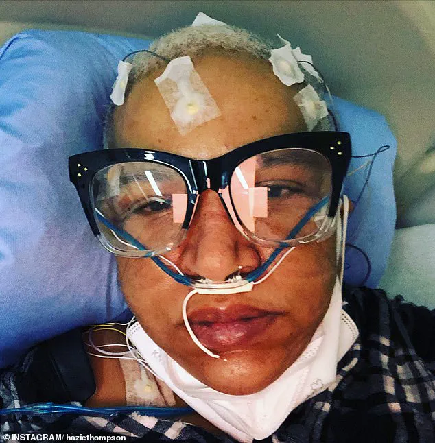 Study Links Long Covid to Increased Dementia Risk via Choroid Plexus Changes