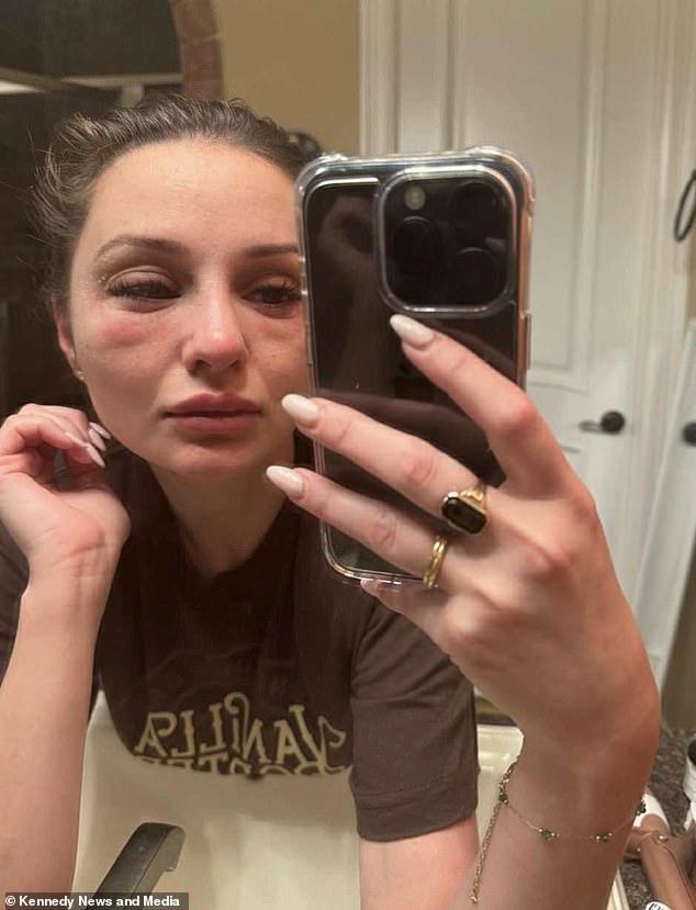 Colorado Student's Hair Loss Unveils Hidden Home Hazard and Health Crisis