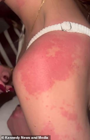 Colorado Student's Hair Loss Unveils Hidden Home Hazard and Health Crisis