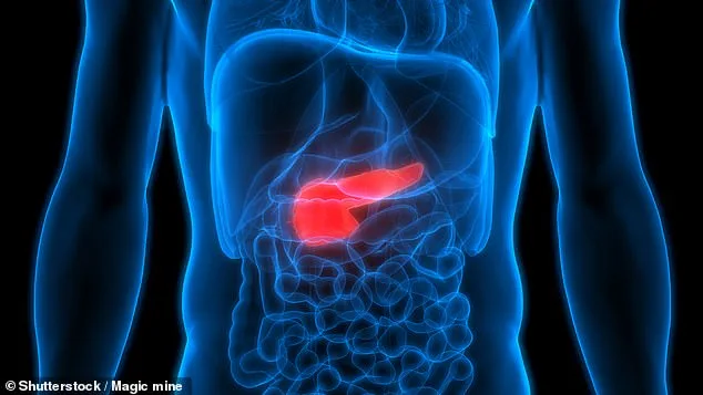 Groundbreaking Study Reveals Link Between Type 2 Diabetes and Pancreatic Cancer Risk