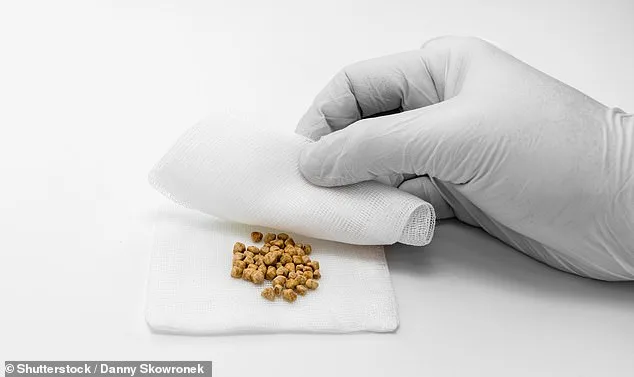 Cheese May Reduce Gallstone Risk, Study Challenges Saturated Fat Beliefs