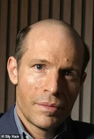 From Confidence to Crisis: James Fairview's Hair Loss Battle and the Universal Struggle