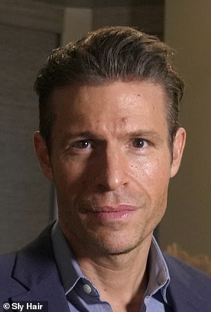 From Confidence to Crisis: James Fairview's Hair Loss Battle and the Universal Struggle