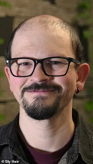 From Confidence to Crisis: James Fairview's Hair Loss Battle and the Universal Struggle