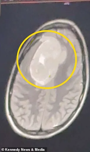 Gut Instincts Ignored: Gillian Keating's Battle with Misdiagnosis