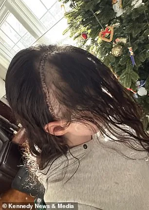 Gut Instincts Ignored: Gillian Keating's Battle with Misdiagnosis