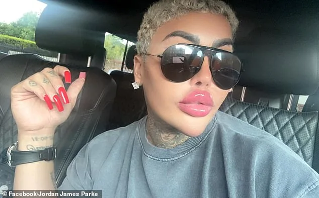 Arrests in 'The Lip King' Jordan James Parke's Death Spark Legal Inquiry into Liquid BBL Risks