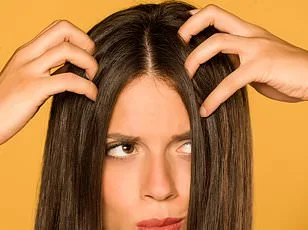 Seborrheic Dermatitis Soars: Microbial Shifts and Modern Living Fuel Public Health Crisis