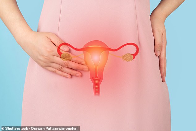 The Urgent Need for Early Ovarian Cancer Detection: Saving Lives in the UK