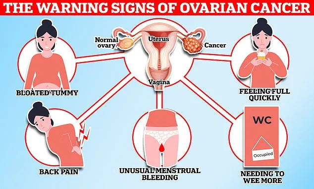 The Urgent Need for Early Ovarian Cancer Detection: Saving Lives in the UK